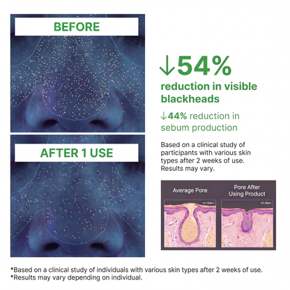 Holy Basil Bubble Deep Mask | Blackhead Removal & Pore Cleansing, Purifying Clay Wash-Off Pack, Carbonated Water, for Sensitive Skin | Korean Skincare, 90g / 3.17 oz